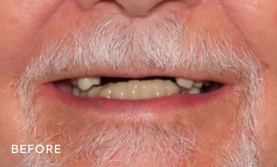 before look at a patient's smile