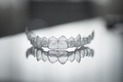 closeup look of Reveal clear aligners